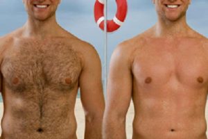 palm beach hair removal before-and-after
